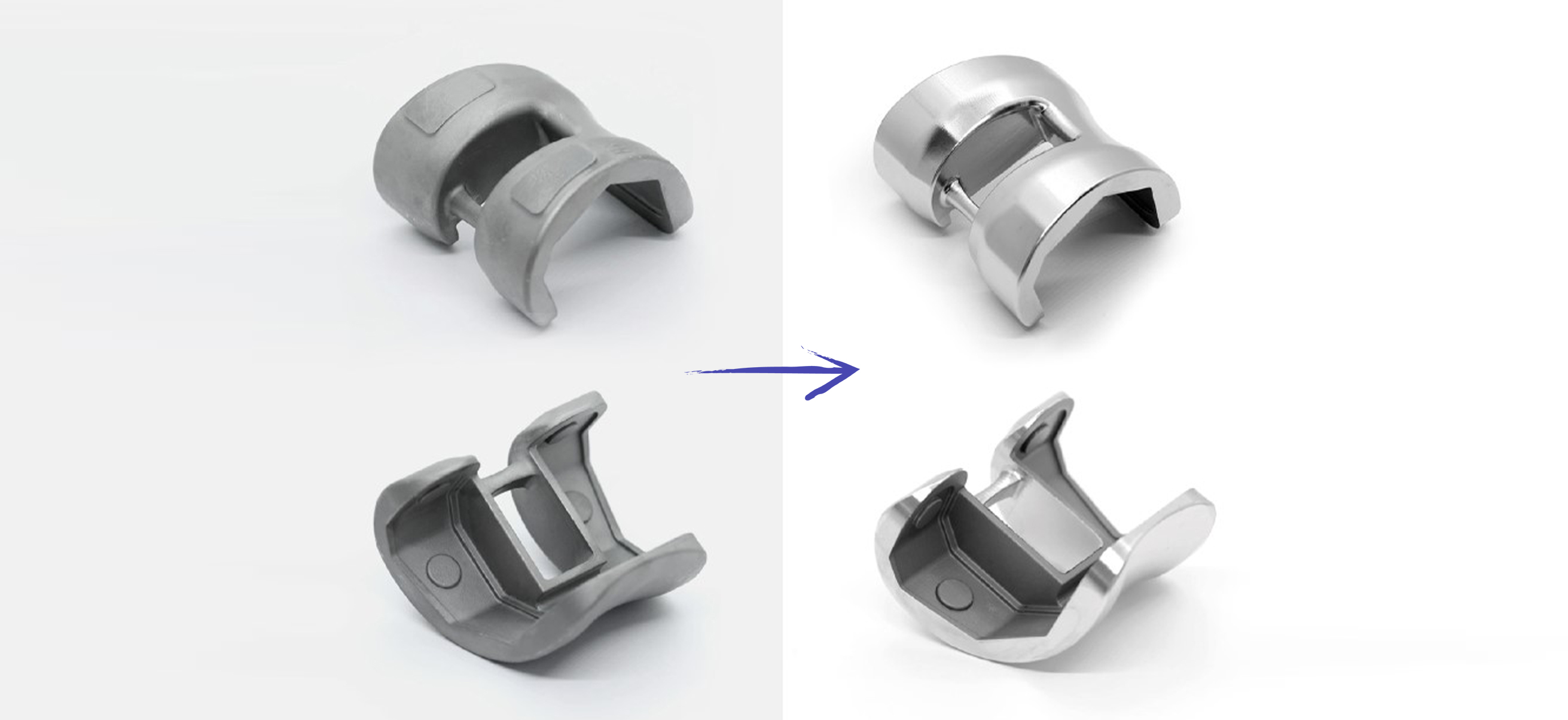Femoral component before-after