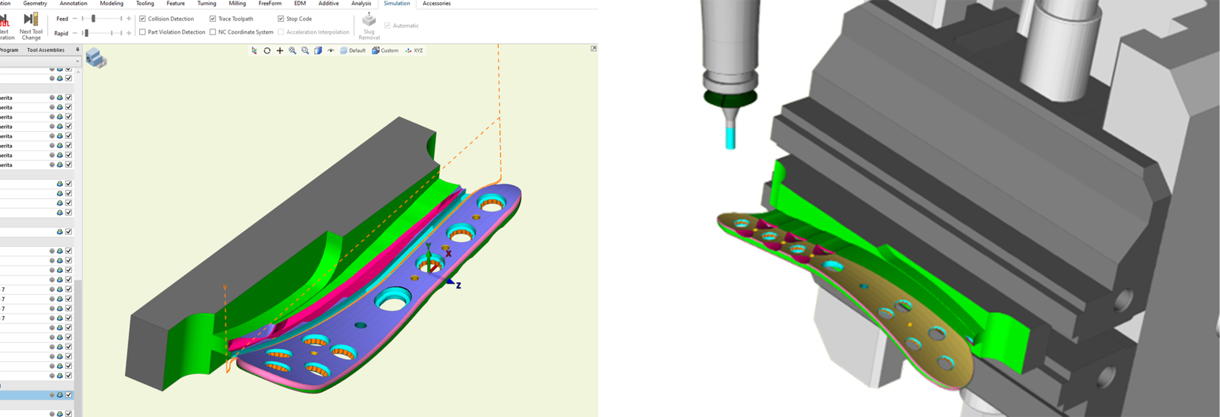Tibial Plate complex geometry